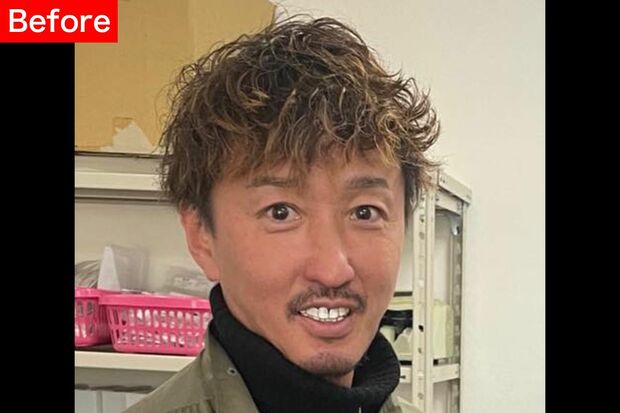 【After】ハリのある目元で「脱おじさん」！たるんだ頬はスッキリ切除。くまを取って若々しい印象に。脂肪吸引と糸リフトでたるみを改善させ、シャープなラインをつくった。