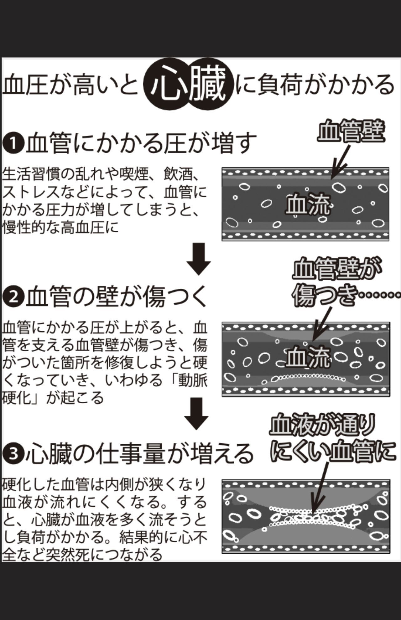 血圧が高いと心臓に負荷がかかる