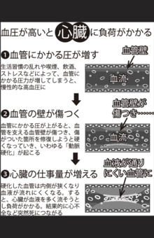 血圧が高いと心臓に負荷がかかる