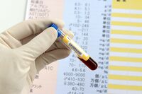 「血液型別かかりやすい病気」には医学的根拠があった！医師が解説、A型はがん、B型は肺炎、O型は胃潰瘍、A…