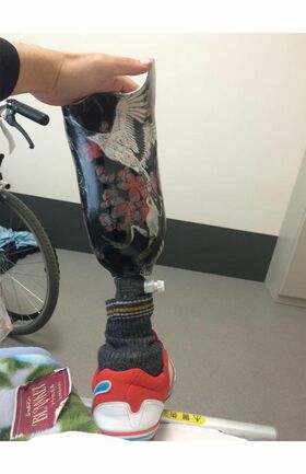 事故から4か月後、森野徹容疑者が作った和柄デザインの義足（本人Facebookより）