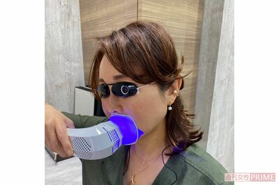 今泉先生が「レディッチトリプロ」をホワイトニングとして使用している姿