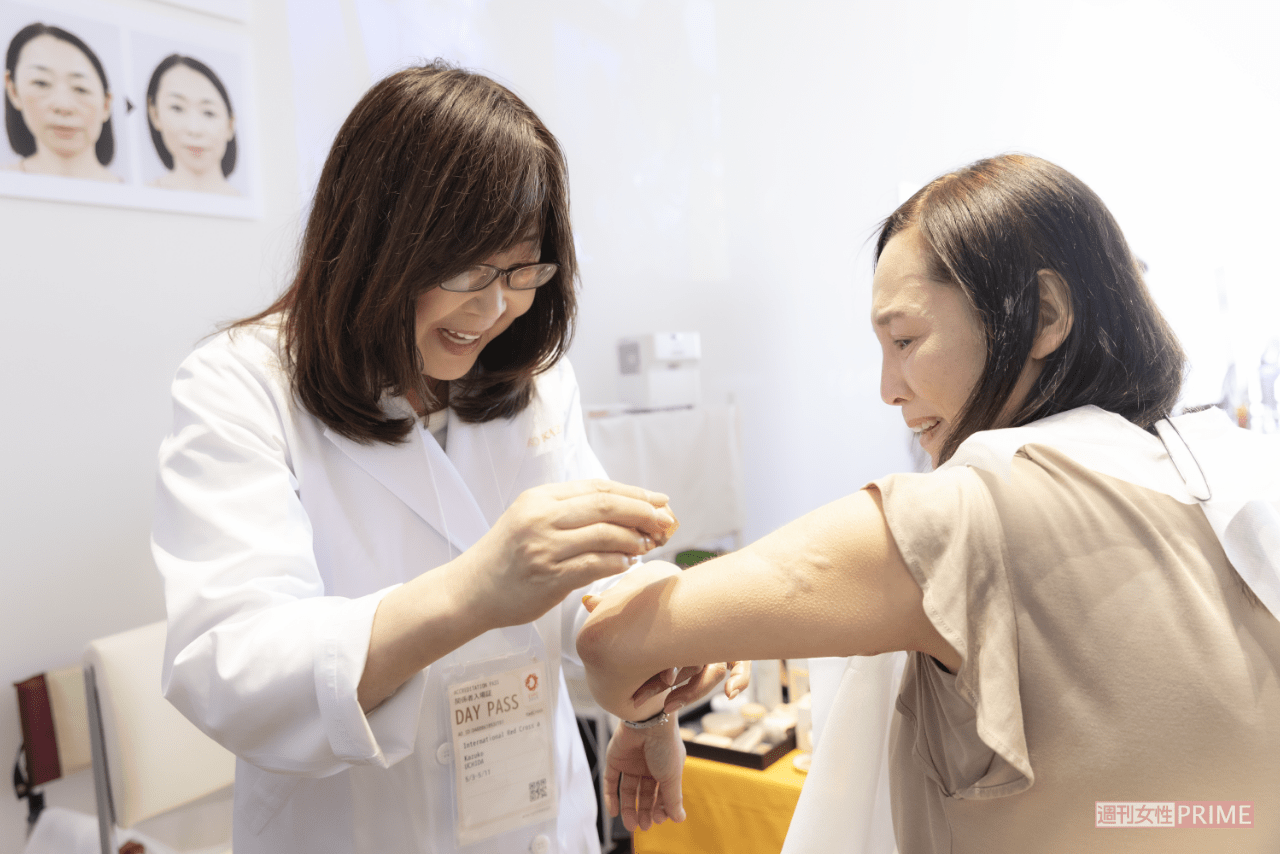 幼稚園のころから、ケロイドに悩んできたAさんは、リハビリメイクで目立たなくなると、「ふたをしていた気持ちが突然開いたみたい……」と喜び、涙した（撮影／矢島泰輔）