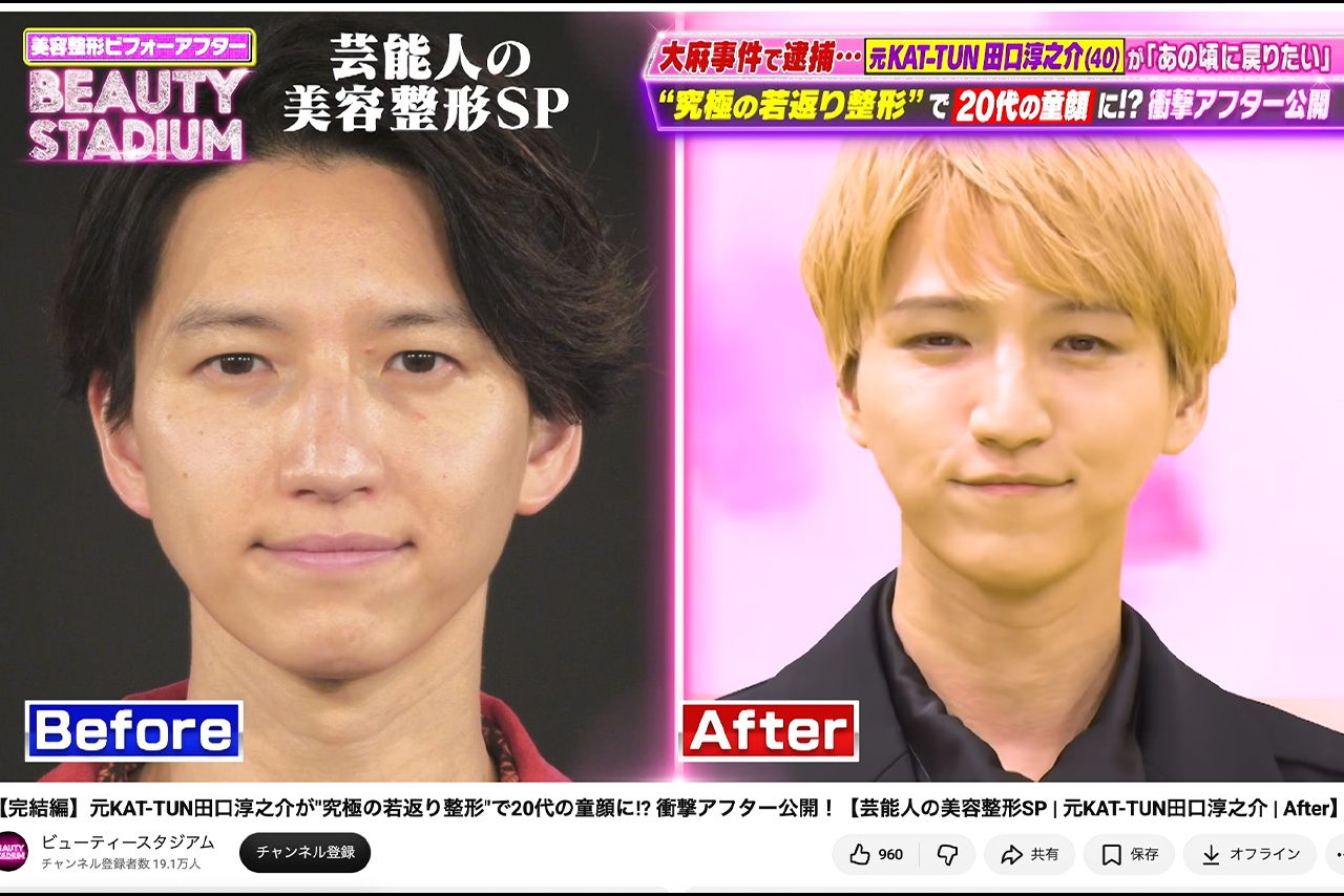 YouTube番組『ビューティースタジアム』で若返り整形に挑戦した田口淳之介。ビフォーと比べると若々しい印象に