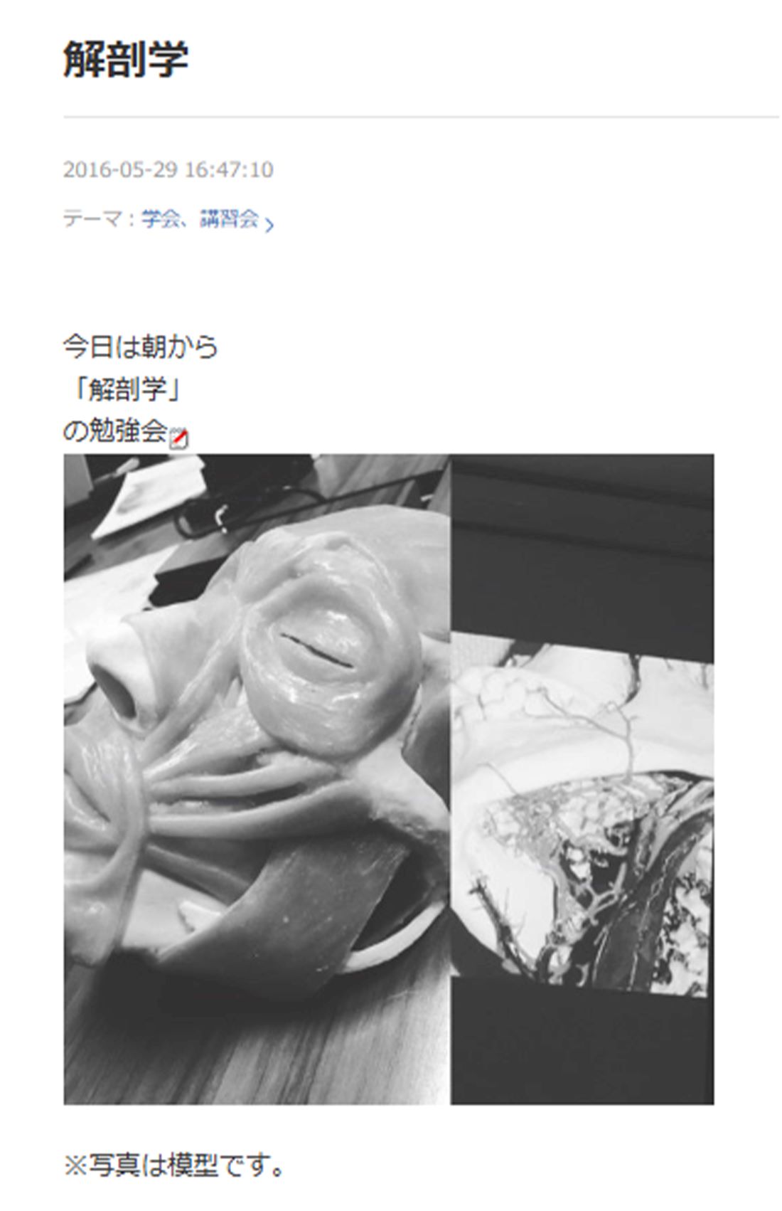 黒田あいみ氏は熱心に解剖学について学んでいたそう（本人アメブロより）