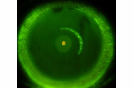 表層角膜炎（写真提供／糸井素純）