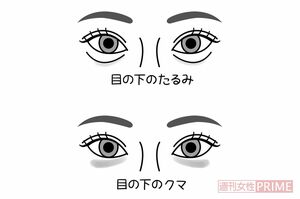 目の下の異変　イラスト／石崎伸子