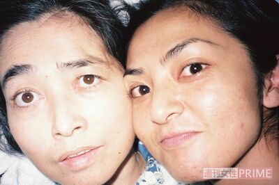 がんが見つかり、在宅医療での広美さんの介護と仕事を両立させていた亞聖さん。小野先生は、彼女を中心にきょうだいが団結していることで、在宅医療にゴーサインを出したという