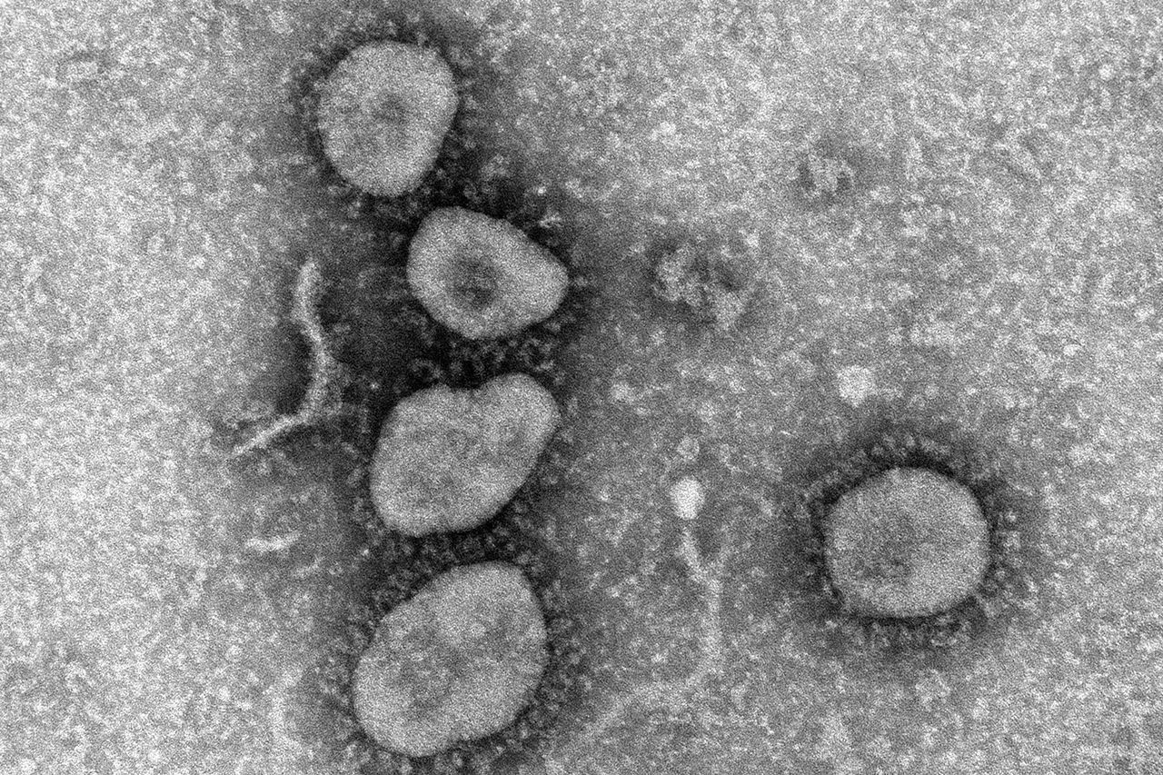 新型コロナウイルスの電子顕微鏡写真（国立感染症研究所より）