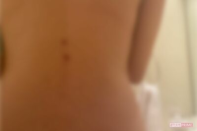 2回目の暴力を受けた際の、絵莉さんの怪我の様子。思いきり蹴り飛ばされたとき、廊下に置いてあったマッサージ台にぶつかってできた背中の傷も生々しい（絵莉さん提供、編集部で一部加工）