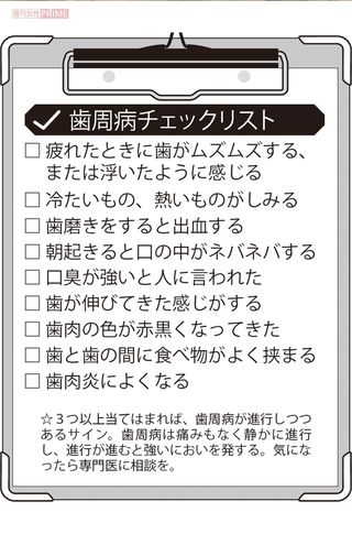歯周病チェックリスト
