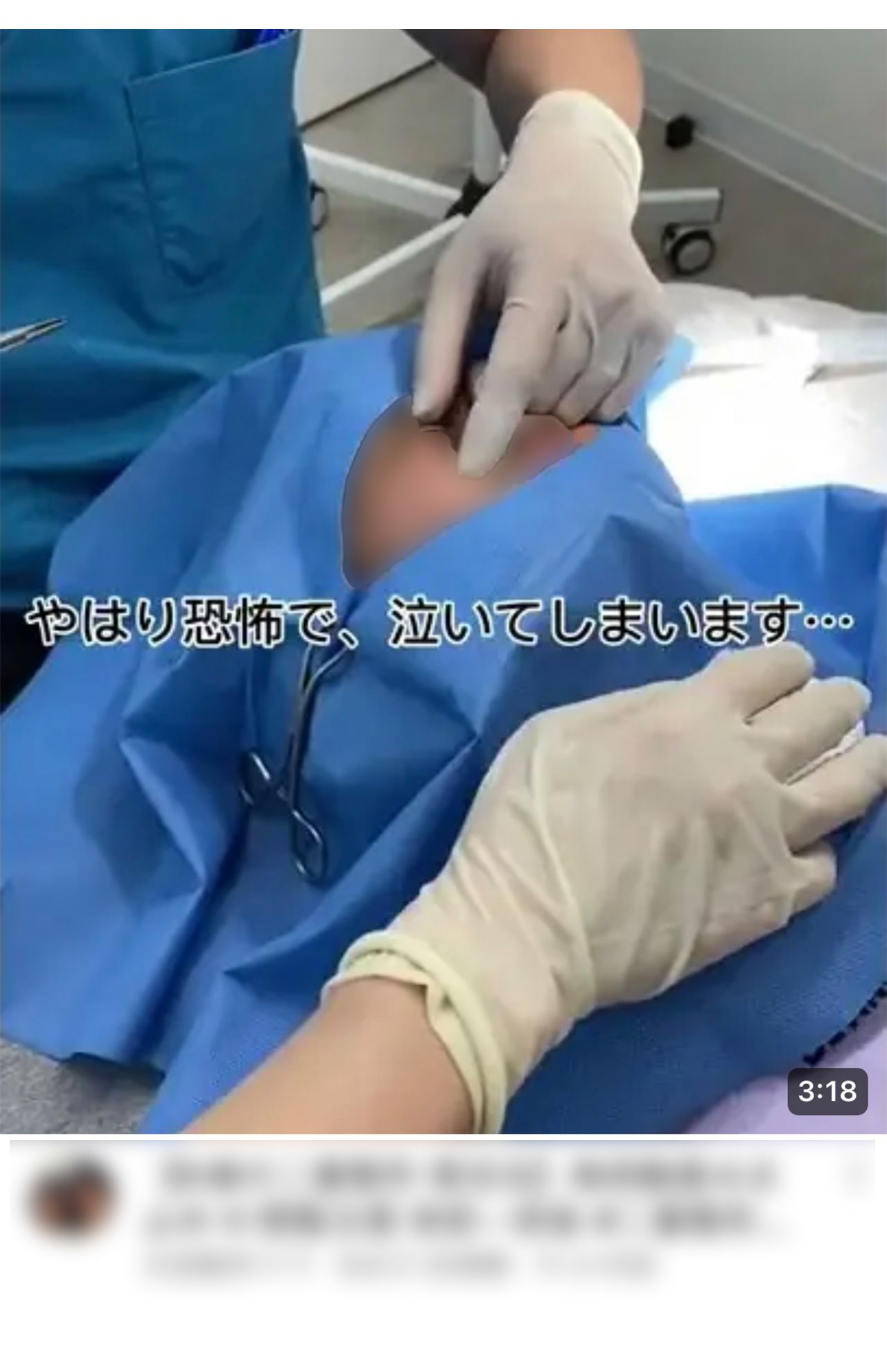 9歳の娘が二重整形する動画がSNSで炎上したケースも（本文登場の親子とは無関係です）