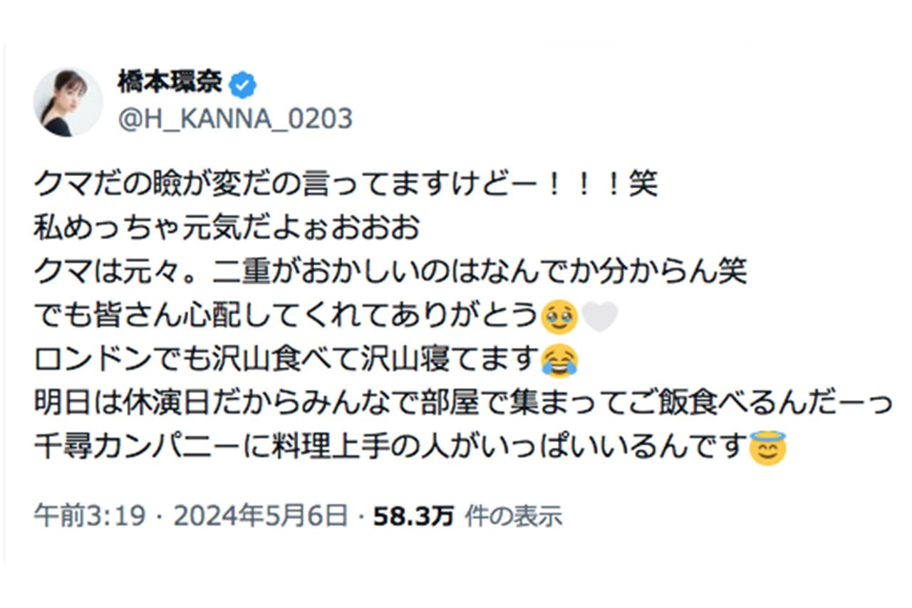 目の下のクマの指摘に明るく釈明する橋本環奈（本人Xより）