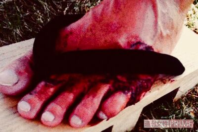 鼻緒に血で指が固まってしまい、激痛の中、完走後には氷水に足をつけて引き剥がしていたという。当然、水は血で真っ赤に