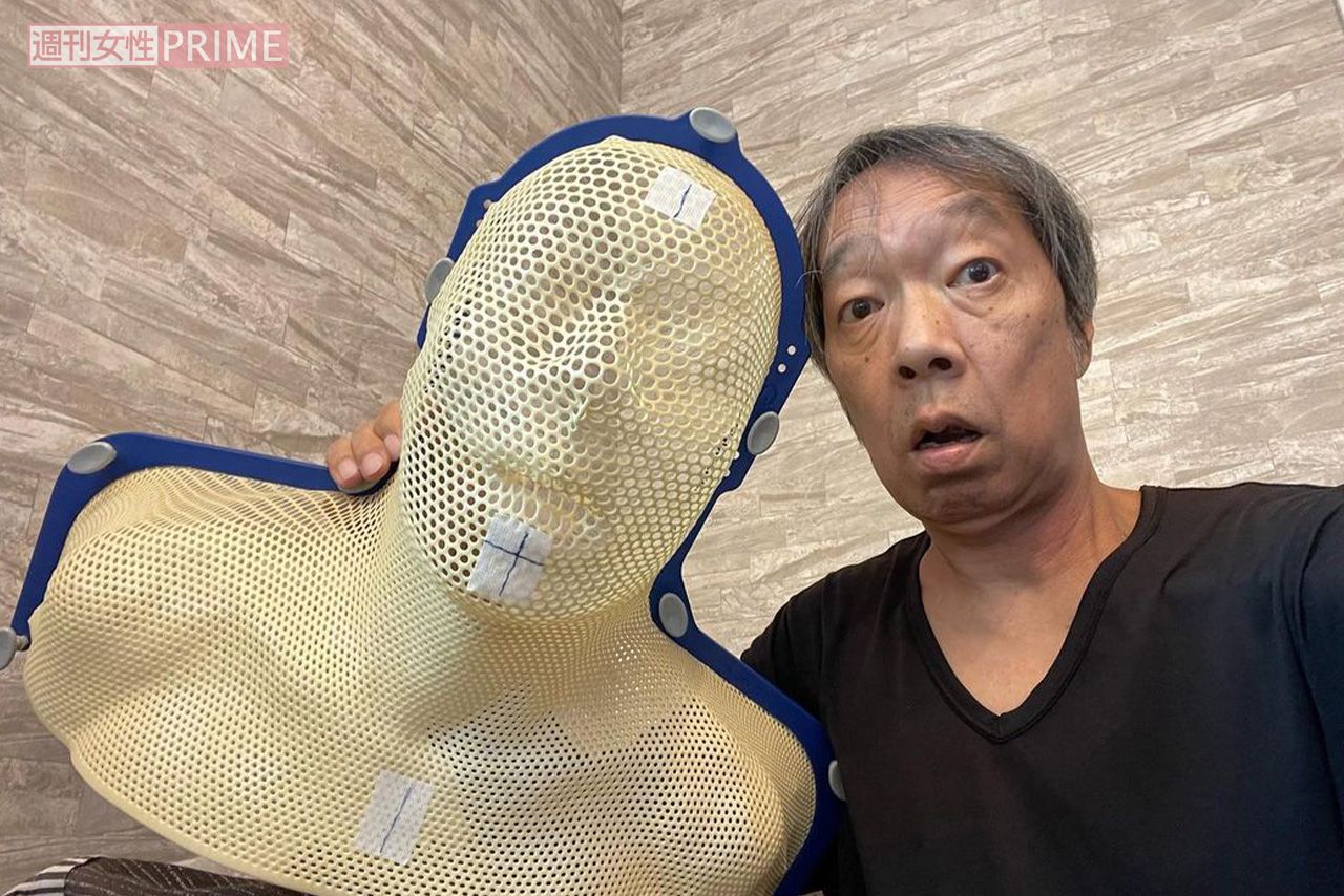 放射線治療に必要な、自身の型取りも行った。放射線をミリ単位で照射するため、この面で身体を固定する必要があるそう。「とんねるずの『生ダラ』でやっていた特殊メイクを思い出しました（笑）」