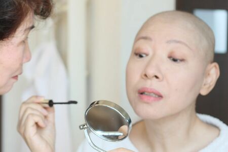 想定はしていた抗がん剤による脱毛。「家族が笑い飛ばしてくれたから、私も笑って乗り越えられました」と財目かおりさん