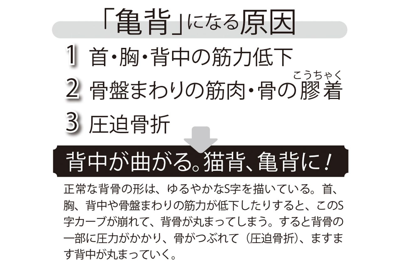 「亀背」になる原因