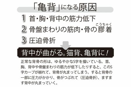 「亀背」になる原因