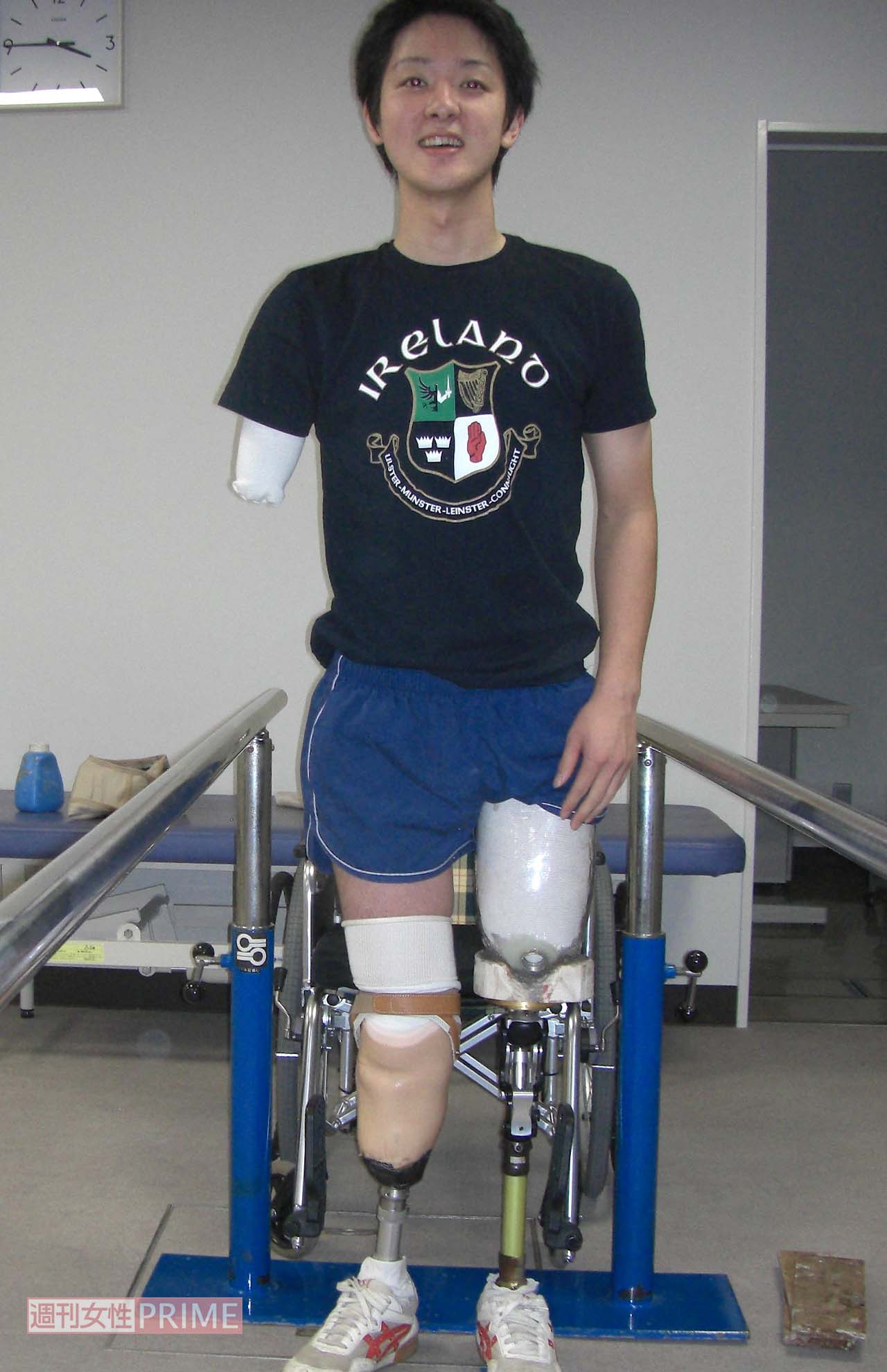 事故から約3か月、初めて義足をつけて感動の涙を流した　写真提供／山田千紘さん