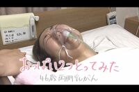 乳がん取材20年の報道記者が「両側乳がん」に、取材“する側”から“される側”になってわかったこと「世の…