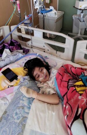 右胸の管から栄養の点滴を入れ、腸の管から排液を外に出しており、常につながれている状態（写真は本人提供）