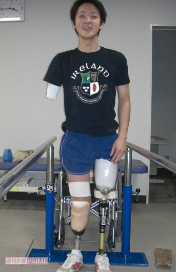 事故から約3か月、初めて義足をつけて感動の涙を流した　写真提供／山田千紘さん