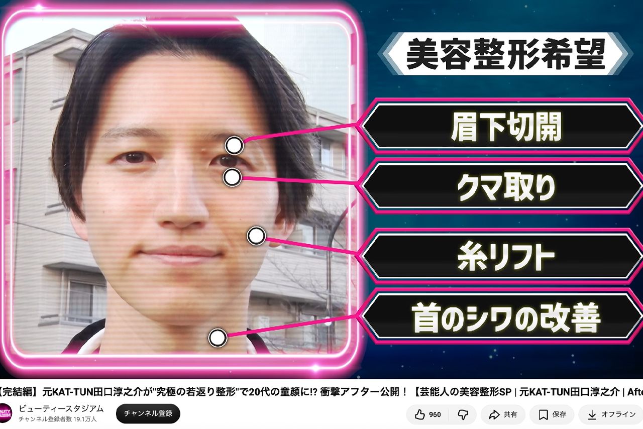 YouTube番組『ビューティースタジアム』で若返り整形に挑戦した田口淳之介