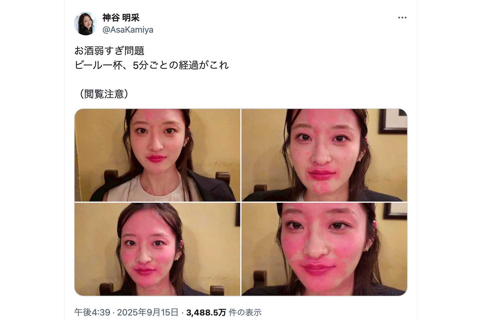 「閲覧注意」としてビール飲酒後の姿を投稿したミス東大の神谷明采（本人のインスタグラムより）